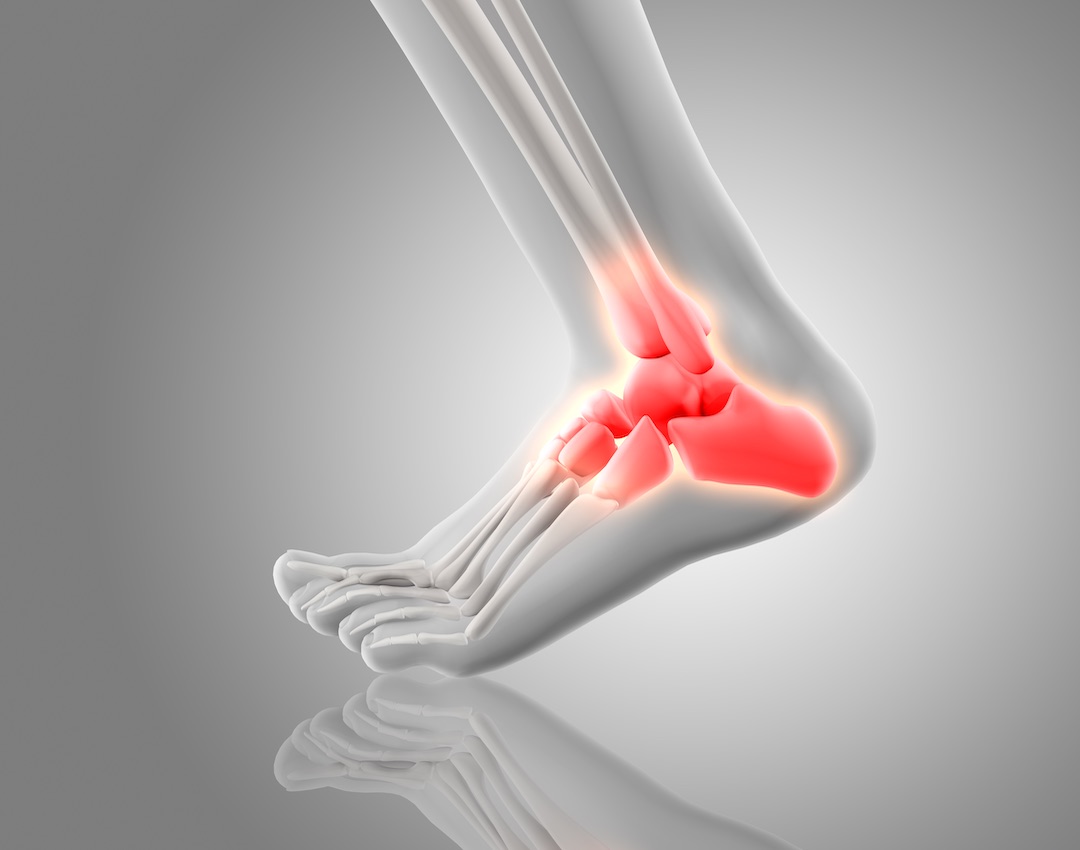 Pembrokeshire foot clinic biomechanical service